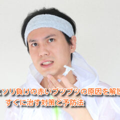 カミソリ負けの赤いブツブツの原因を解説!すぐに治す対策と予防法